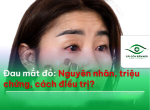 Đau mắt đỏ