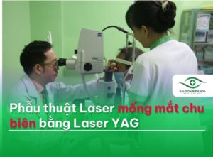 Phẫu thuật laser mống mắt chu biên